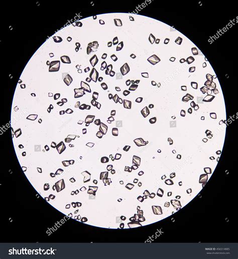 Uric Acid Crystals In Urine – NBKomputer