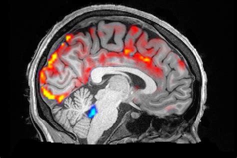 How Electrical Activity Travels through the Brain | The Brink | Boston ...