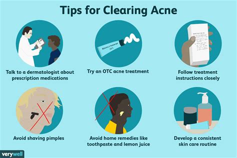 10 Smart Ways to Treat Teen Acne in Boys