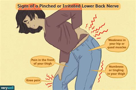 Back Disorders and Knee Pain