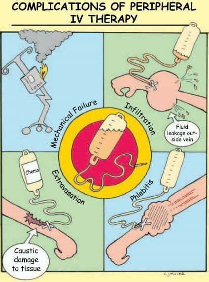 Complications of peripheral IV therapy Nursing School Studying, Nursing School Notes, Nursing ...
