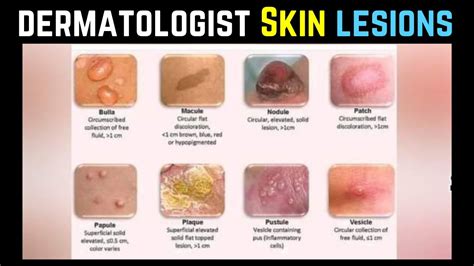 Dermatologist Skin Lesions: Clinical Features | Dermatology -ا ردو ...