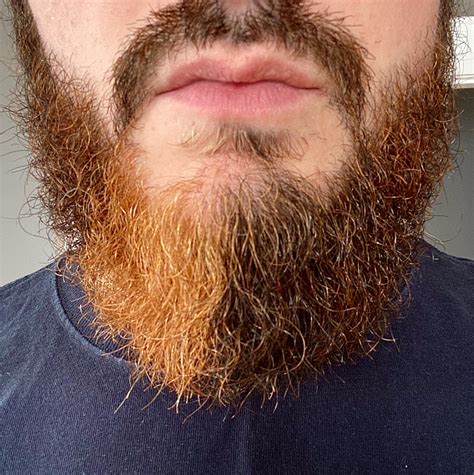 My beard grows 1/4 orange and is split at pretty much the middle of my ...