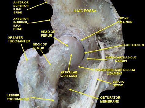 Paediatric Hip Disorders | Perthes, DDH, SCFE | Geeky Medics