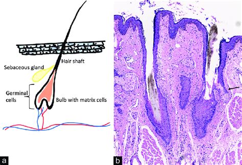 Schematic representation of a pilosebaceous unit of the eyelash.... | Download Scientific Diagram