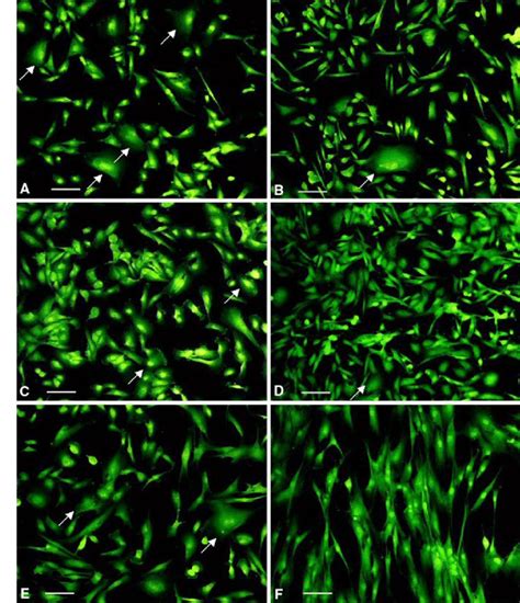 A-F In vitro morphologic features of stromal cells (SC) and human ...