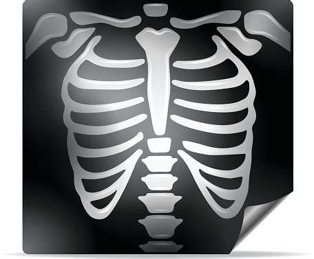 Free Chest Xray Cliparts, Download Free Chest Xray Cliparts png images ...