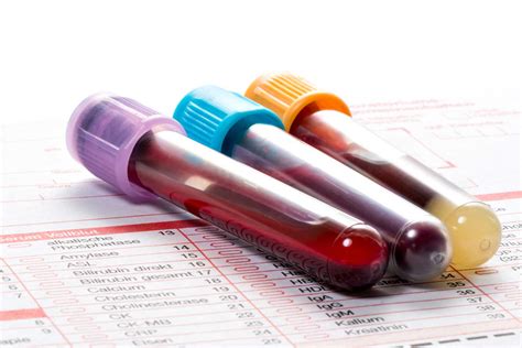 Blood testing tubes — Stanford Blood Center