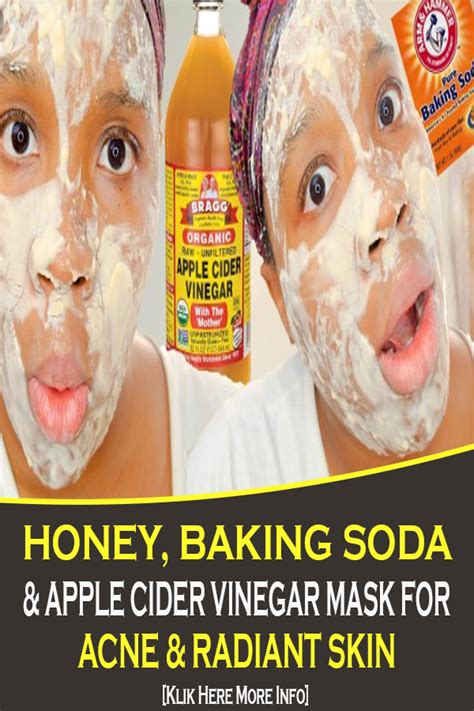 HONEY, BAKING SODA & APPLE CIDER VINEGAR MASK FOR ACNE & RADIANT SKIN ...