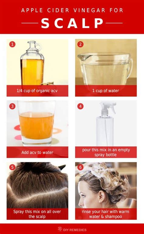 How to use Apple Cider Vinegar for Scalp