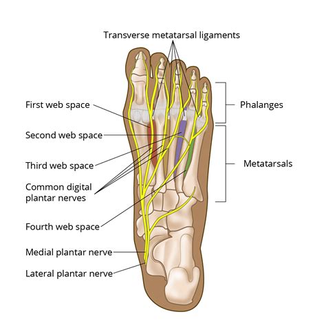 Morton's Neuroma - OrthoInfo - AAOS