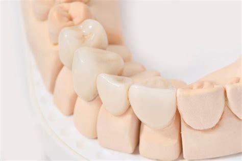 Dentures - Pros and Cons