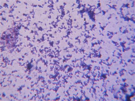 Cureus | Bacterial Colony: First Report of Donut Colony Morphology among Diphtheroids Isolated ...