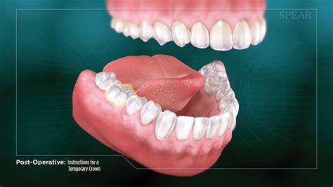 Dental Animations - Gray Creative