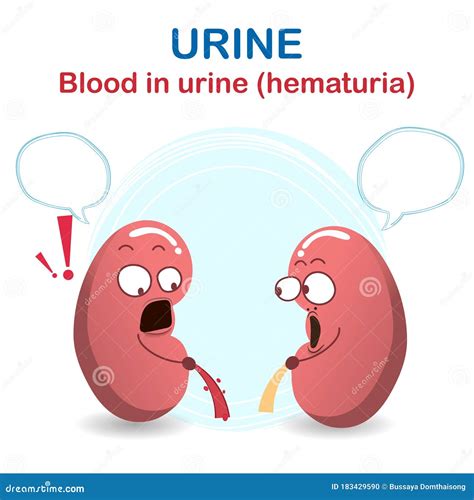 Hematuria Cartoons, Illustrations & Vector Stock Images - 234 Pictures ...