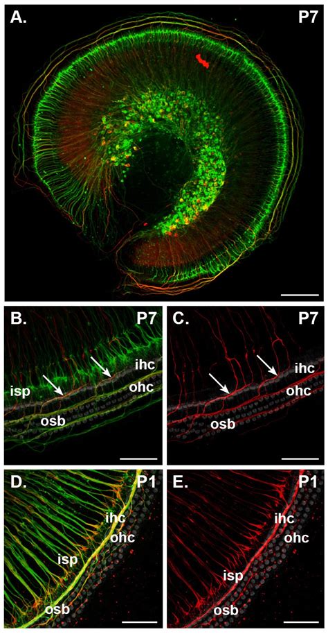 Type I vs type II spiral ganglion neurons exhibit differential survival ...