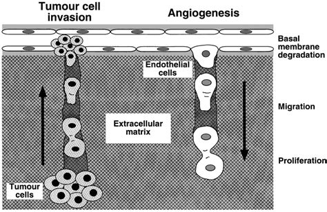 Tumor cell invasion leading to the spread of metastases and ...