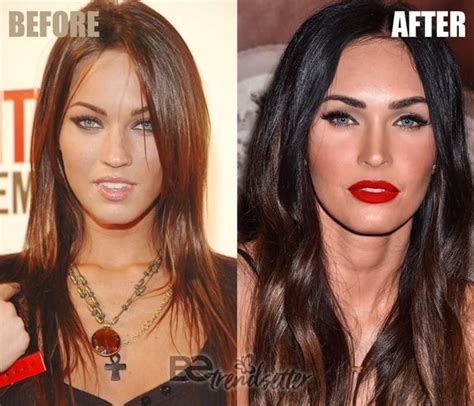 Megan Fox Plastic Surgery Before And After REVEALED! 2018