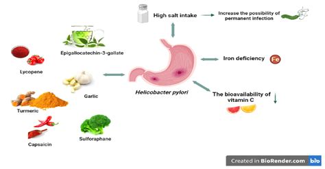 Diseases | Free Full-Text | Overview of Helicobacter pylori Infection: Clinical Features ...