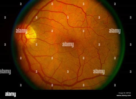 Fundus camera hi-res stock photography and images - Alamy