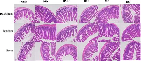 Histopathology of the duodenum, jejunum, and ileum | Download ...