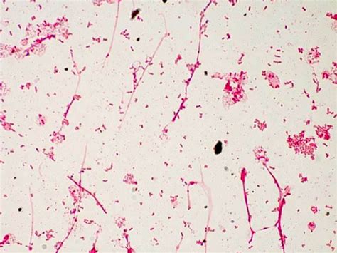 Serratia Marcescens Colony Morphology