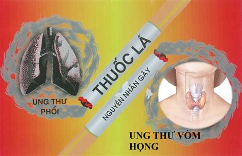 Ung thư vòm họng: Dấu hiệu, và cách phòng tránh