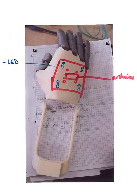 Economic Prosthetic Hand | Hackaday.io