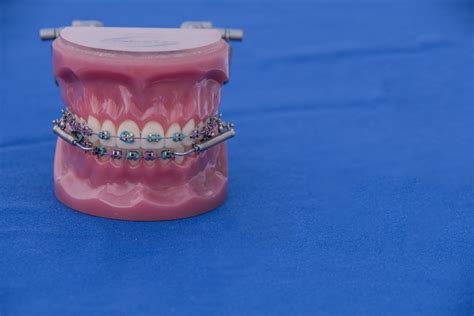 Teeth Mockup Background Free Stock Photo - Public Domain Pictures