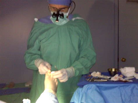 Ledderhose Disease Blog: Interview with surgery plantar fibroma patient ...