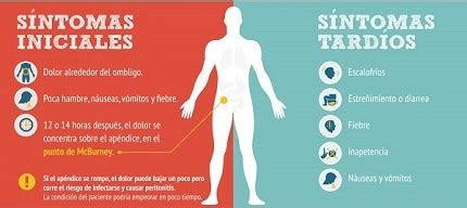 Apendicitis - Generalidades