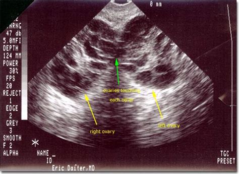 Dr. Eric Daiter, MD - Infertility Procedures and Treatments ...