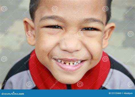 Smiling Asian Boy Exposing Decaying Teeth. Stock Photo - Image: 22133460