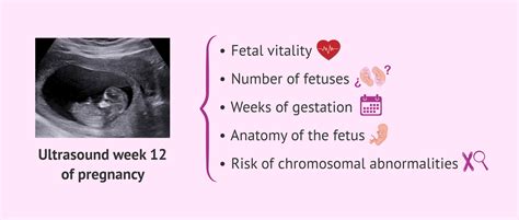 12-week ultrasound scan