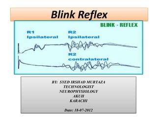 Blink reflex | PPT