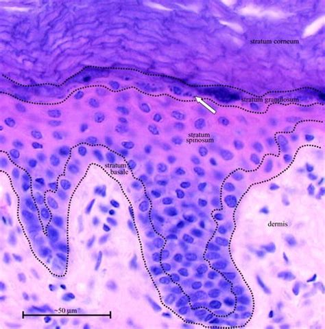 Mechanobiology of Epidermal Keratinocytes: Desmosomes, Hemidesmosomes ...