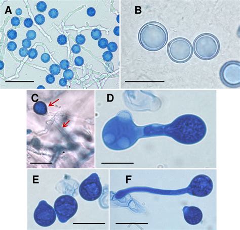 (A) Hyaline, coenocytic hyphae of Conidiobolus lamprauges strain ...