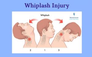 Whiplash Injury: Diagnosis and Treatment | Dubai, UAE | Westminster Ortho Med Clinic | Dubai ...