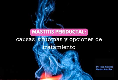 Mastitis periductal: causas, síntomas y opciones de tratamiento – Dr ...