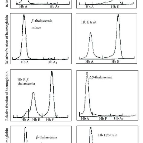 Electropherograms showing different types of haemoglobinopathies. | Download Scientific Diagram