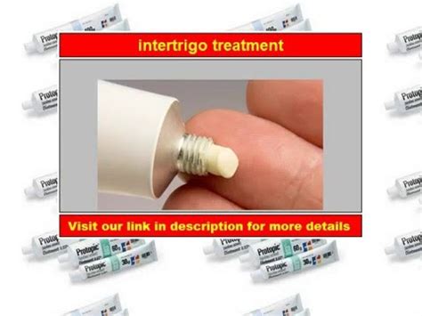 Intertrigo treatment - YouTube