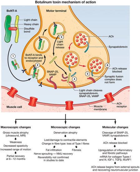 Toxins | Free Full-Text | How Does Botulinum Toxin Inhibit Itch?