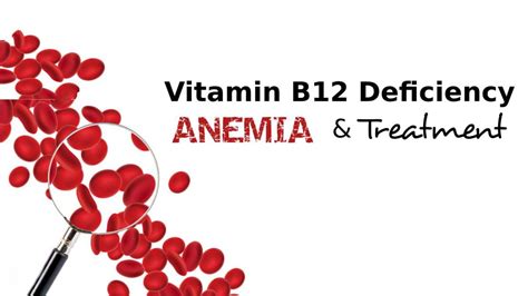 Vitamin B12 Deficiency Anemia And Treatment