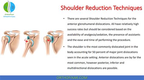 Shoulder Reduction Techniques | OrthoFixar 2024