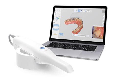 Intraoral scanners: Brand comparison, uses, and more | Dandy