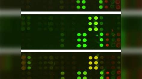 How many COVID-19 infections are asymptomatic? Research shows it may be ...