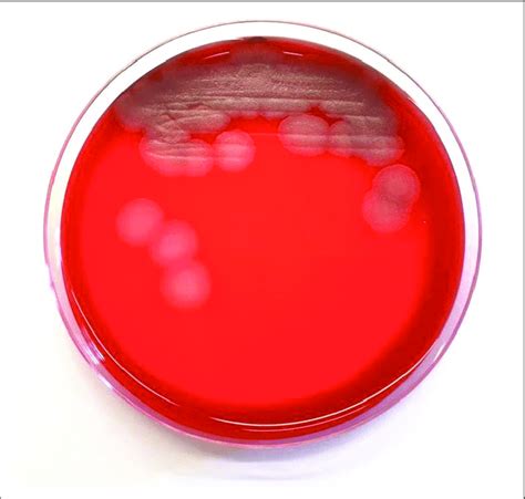 Typical morphology of Bacillus cereus on 5% horse blood agar (Pretoria,... | Download Scientific ...