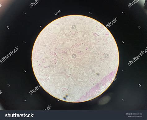 Trichinella Spiralis Encysted Larva Light Microscope Foto de stock ...