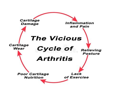 Vicious Cycle of Arthritis stock photo. Image of inflammation - 177206658