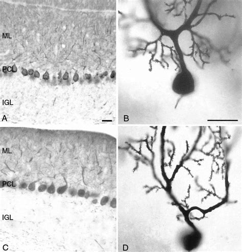 Calbindin immunohistochemistry staining in adult wild-type (A, B) and ...